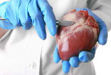 مدت زمان به هوش آمدن بعد از عمل قلب باز