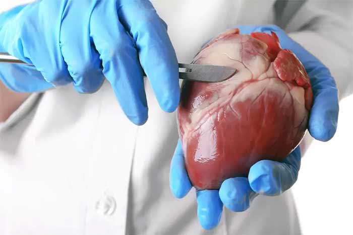 به هوش آمدن مدت زمان به هوش آمدن بعد از عمل قلب باز